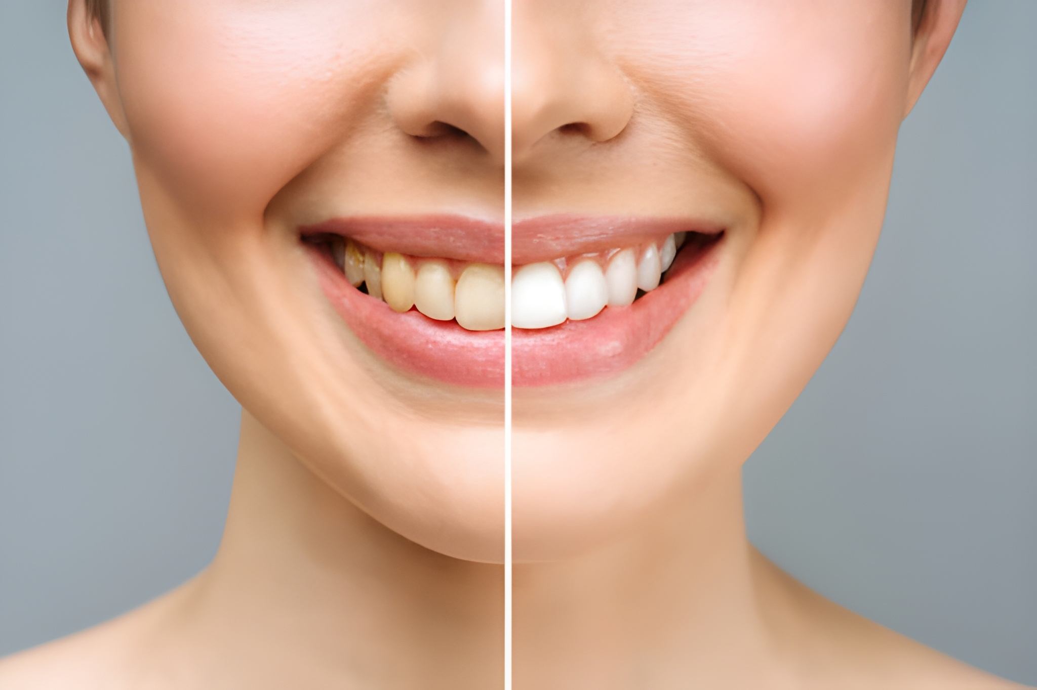 Cosmetic Dentistry